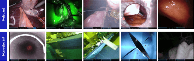 Figure 1 for Automatic Detection of Out-of-body Frames in Surgical Videos for Privacy Protection Using Self-supervised Learning and Minimal Labels
