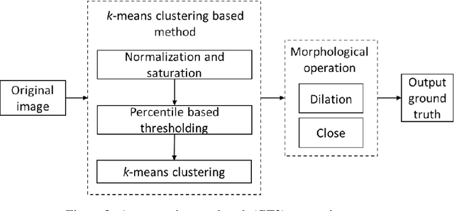 Figure 3 for Treatment classification of posterior capsular opacification (PCO) using automated ground truths