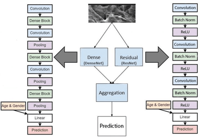 Figure 3 for JointNET: A Deep Model for Predicting Active Sacroiliitis from Sacroiliac Joint Radiography