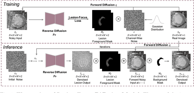 Figure 1 for LeFusion: Synthesizing Myocardial Pathology on Cardiac MRI via Lesion-Focus Diffusion Models