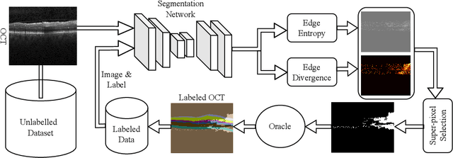Figure 1 for EdgeAL: An Edge Estimation Based Active Learning Approach for OCT Segmentation