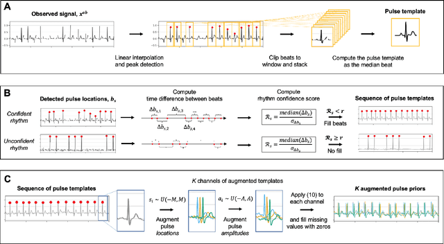 Figure 1 for Improving Diffusion Models for ECG Imputation with an Augmented Template Prior