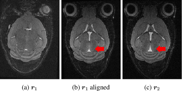 Figure 2 for DELTA-MRI: Direct deformation Estimation from LongiTudinally Acquired k-space data