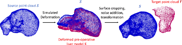 Figure 1 for Learning Feature Descriptors for Pre- and Intra-operative Point Cloud Matching for Laparoscopic Liver Registration