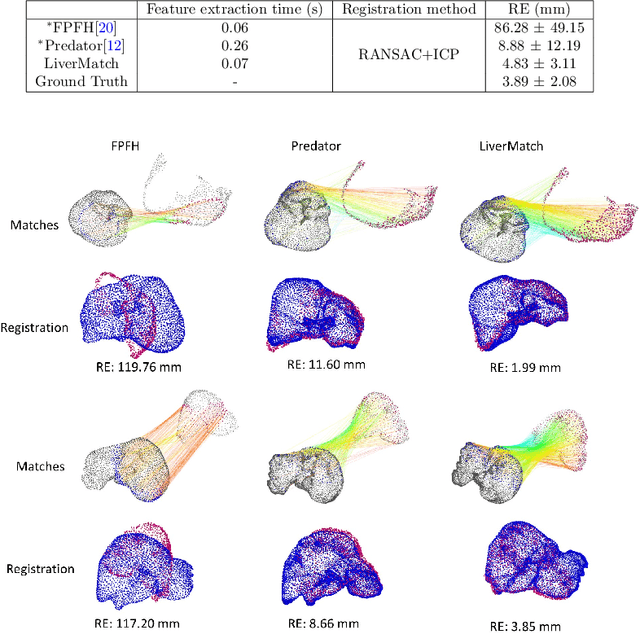Figure 4 for Learning Feature Descriptors for Pre- and Intra-operative Point Cloud Matching for Laparoscopic Liver Registration