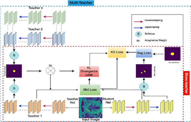 Figure 1 for Knowledge Distillation for Adaptive MRI Prostate Segmentation Based on Limit-Trained Multi-Teacher Models