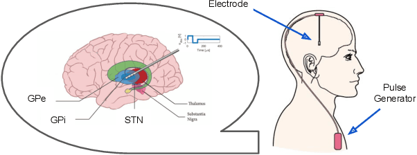 Figure 1 for ε-Neural Thompson Sampling of Deep Brain Stimulation for Parkinson Disease Treatment