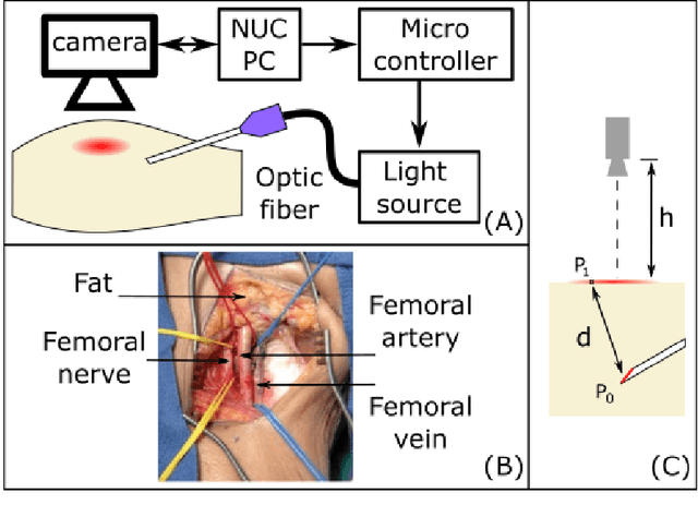 Figure 1 for Medical needle tip tracking based on Optical Imaging and AI