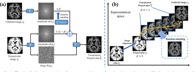 Figure 3 for Robust One-shot Segmentation of Brain Tissues via Image-aligned Style Transformation