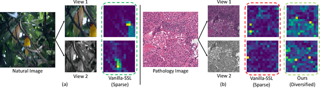 Figure 1 for Attention De-sparsification Matters: Inducing Diversity in Digital Pathology Representation Learning