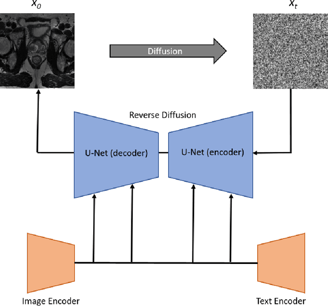 Figure 4 for Bi-parametric prostate MR image synthesis using pathology and sequence-conditioned stable diffusion