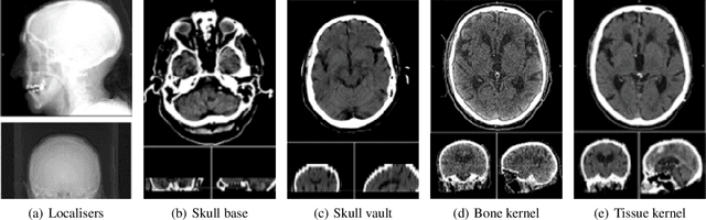 Figure 4 for Challenges of building medical image datasets for development of deep learning software in stroke