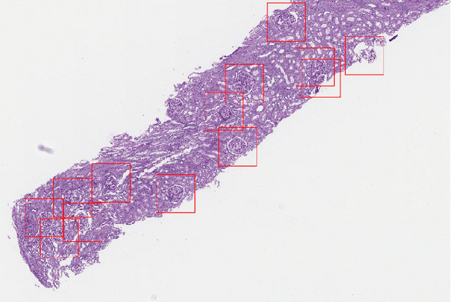 Figure 4 for An Investigation into Glomeruli Detection in Kidney H&E and PAS Images using YOLO