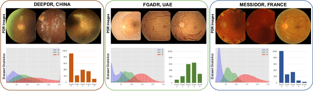 Figure 1 for Towards Generalizable Diabetic Retinopathy Grading in Unseen Domains