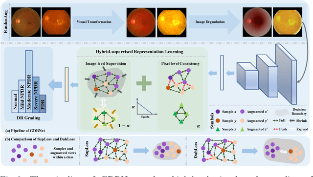 Figure 3 for Towards Generalizable Diabetic Retinopathy Grading in Unseen Domains