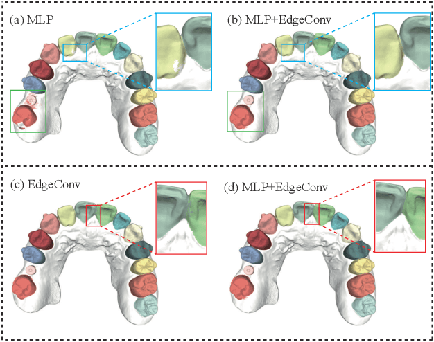 Figure 2 for TFormer: 3D Tooth Segmentation in Mesh Scans with Geometry Guided Transformer