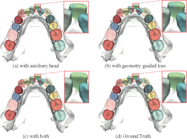 Figure 4 for TFormer: 3D Tooth Segmentation in Mesh Scans with Geometry Guided Transformer