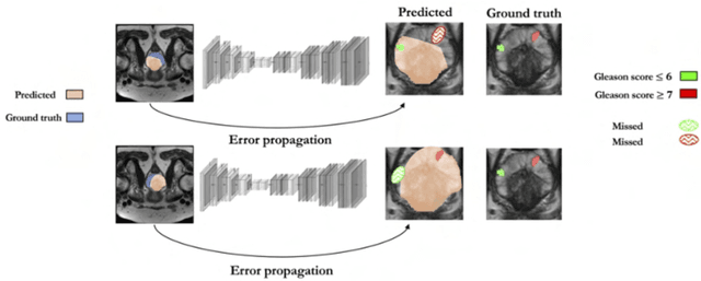 Figure 3 for Reconsidering evaluation practices in modular systems: On the propagation of errors in MRI prostate cancer detection