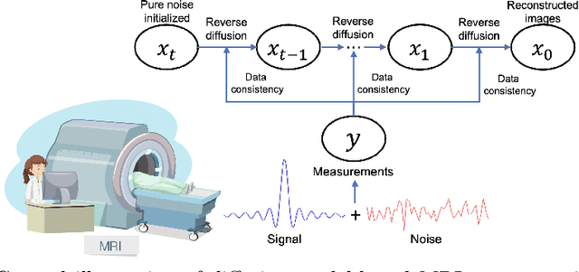 Figure 1 for Noise Level Adaptive Diffusion Model for Robust Reconstruction of Accelerated MRI