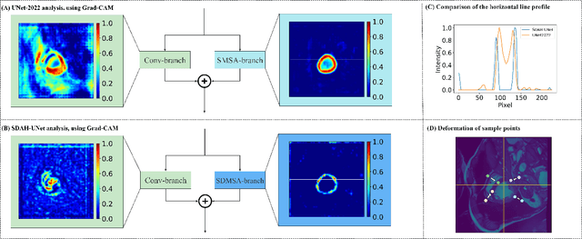 Figure 1 for Swin Deformable Attention Hybrid U-Net for Medical Image Segmentation