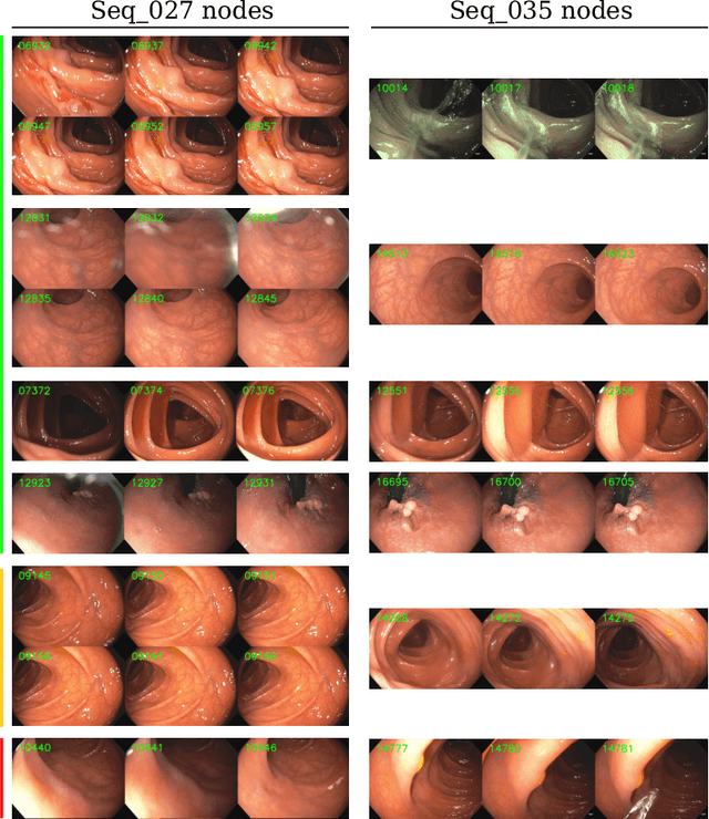 Figure 3 for ColonMapper: topological mapping and localization for colonoscopy