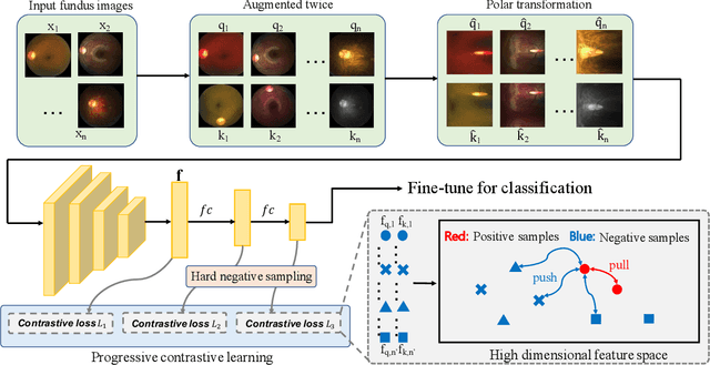 Figure 1 for PoCo: A Self-Supervised Approach via Polar Transformation Based Progressive Contrastive Learning for Ophthalmic Disease Diagnosis