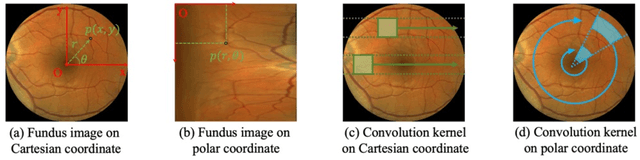 Figure 3 for PoCo: A Self-Supervised Approach via Polar Transformation Based Progressive Contrastive Learning for Ophthalmic Disease Diagnosis