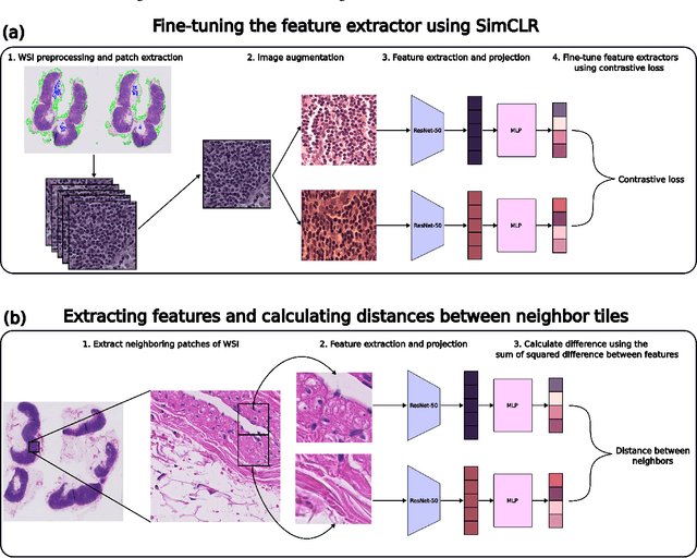 Figure 3 for CAMIL: Context-Aware Multiple Instance Learning for Whole Slide Image Classification