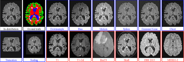 Figure 1 for Improving Uncertainty-based Out-of-Distribution Detection for Medical Image Segmentation