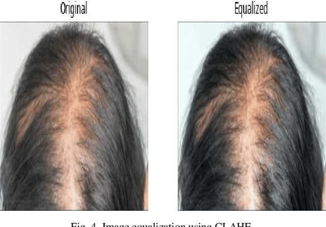 Figure 4 for Hair and Scalp Disease Detection using Machine Learning and Image Processing