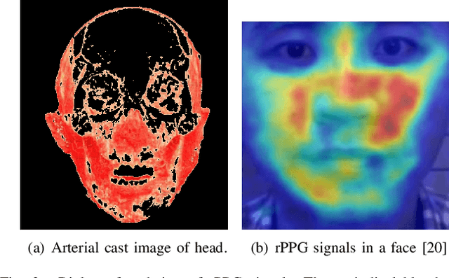 Figure 3 for Mask Attack Detection Using Vascular-weighted Motion-robust rPPG Signals