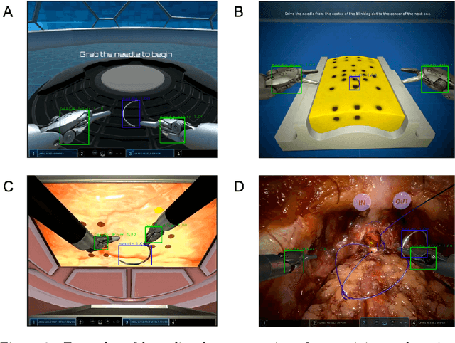 Figure 3 for Objective Surgical Skills Assessment and Tool Localization: Results from the MICCAI 2021 SimSurgSkill Challenge