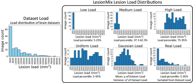 Figure 3 for LesionMix: A Lesion-Level Data Augmentation Method for Medical Image Segmentation
