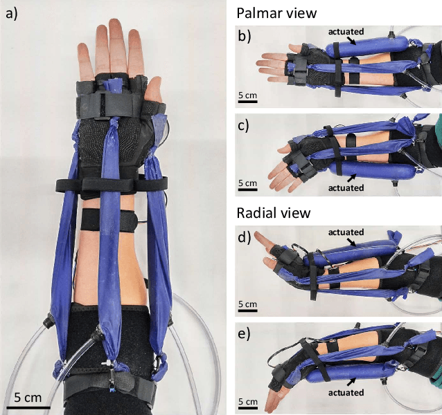 Figure 1 for Soft Wrist Exosuit Actuated by Fabric Pneumatic Artificial Muscles