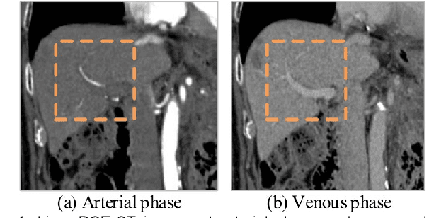 Figure 1 for Structure-aware registration network for liver DCE-CT images