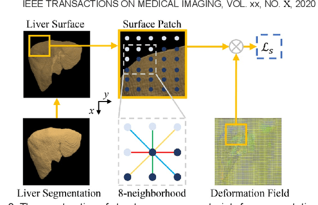 Figure 3 for Structure-aware registration network for liver DCE-CT images