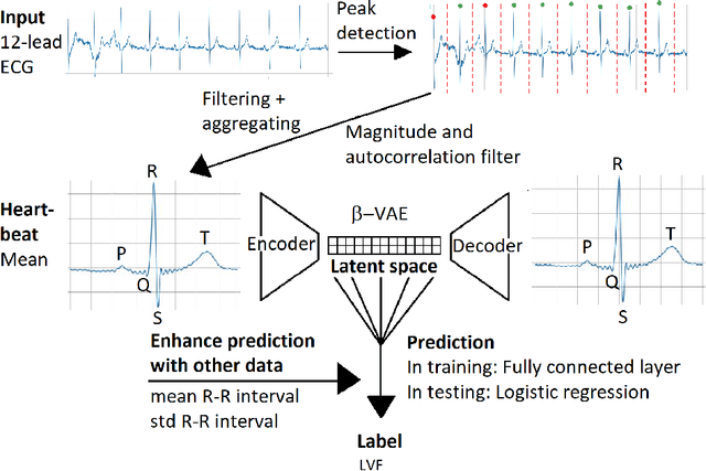 Figure 1 for Joint optimization of a $β$-VAE for ECG task-specific feature extraction