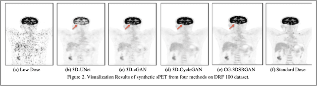 Figure 2 for CG-3DSRGAN: A classification guided 3D generative adversarial network for image quality recovery from low-dose PET images