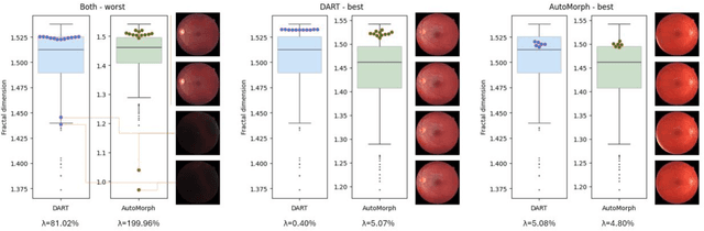 Figure 4 for Applicability of oculomics for individual risk prediction: Repeatability and robustness of retinal Fractal Dimension using DART and AutoMorph