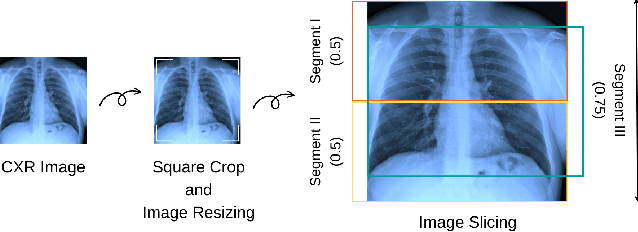 Figure 2 for Automated Chest X-Ray Report Generator Using Multi-Model Deep Learning Approach