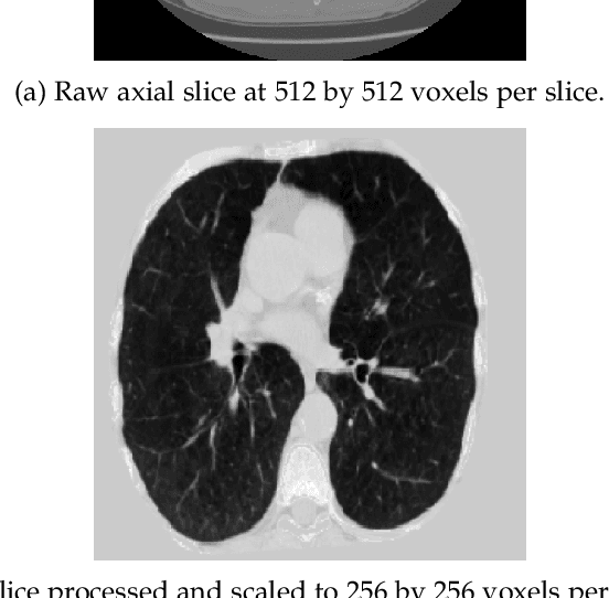 Figure 3 for A hybrid CNN-RNN approach for survival analysis in a Lung Cancer Screening study