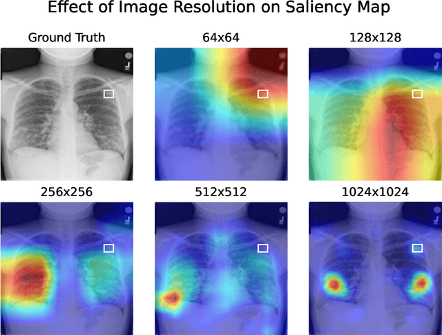 Figure 1 for Exploring the Impact of Image Resolution on Chest X-ray Classification Performance