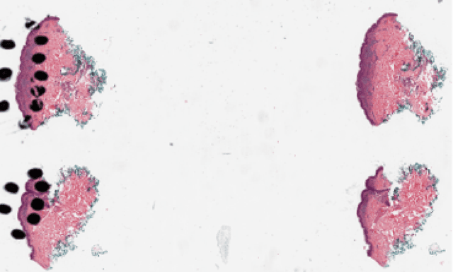 Figure 3 for Region of Interest Detection in Melanocytic Skin Tumor Whole Slide Images