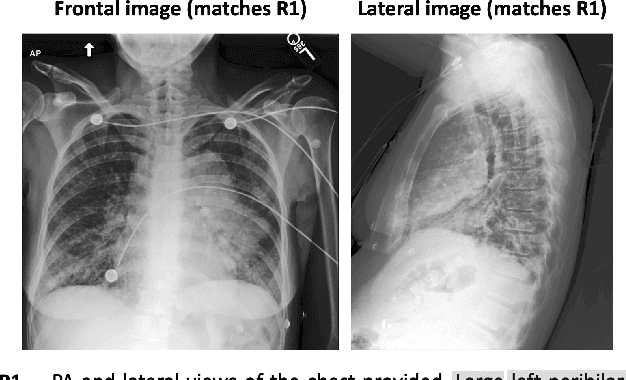 Figure 1 for LIMITR: Leveraging Local Information for Medical Image-Text Representation