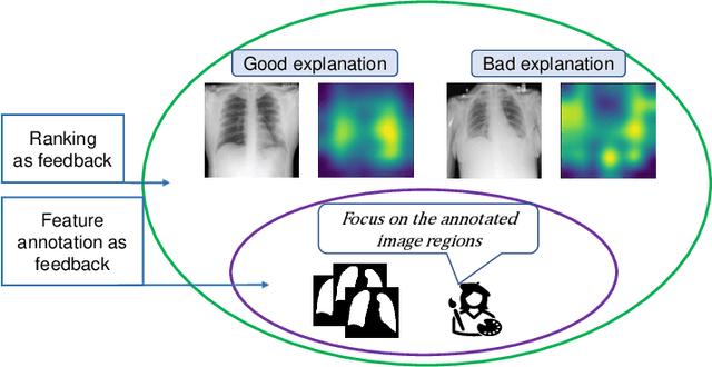Figure 3 for Unlearning Spurious Correlations in Chest X-ray Classification