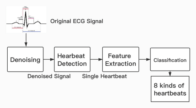 Figure 4 for Machine Learning-Based Automatic Cardiovascular Disease Diagnosis Using Two ECG Leads
