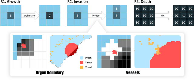 Figure 3 for From Pixel to Cancer: Cellular Automata in Computed Tomography