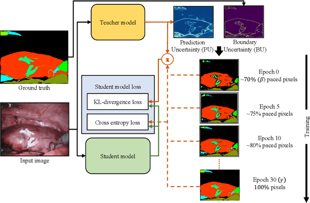 Figure 1 for Paced-Curriculum Distillation with Prediction and Label Uncertainty for Image Segmentation