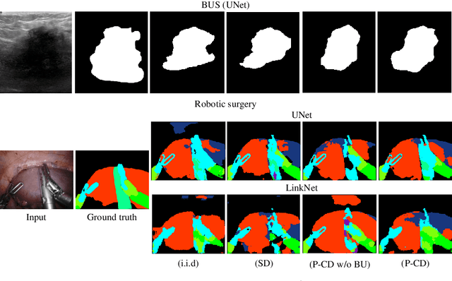 Figure 4 for Paced-Curriculum Distillation with Prediction and Label Uncertainty for Image Segmentation