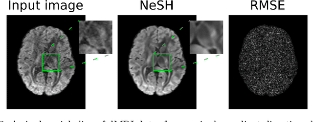 Figure 2 for Neural Spherical Harmonics for structurally coherent continuous representation of diffusion MRI signal